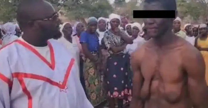 Man develops giant boobs after being sucked for milk by a snake each night