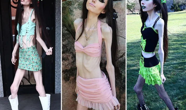 YouTuber Eugenia Cooney's thin look raises alarm with multiple 911 calls