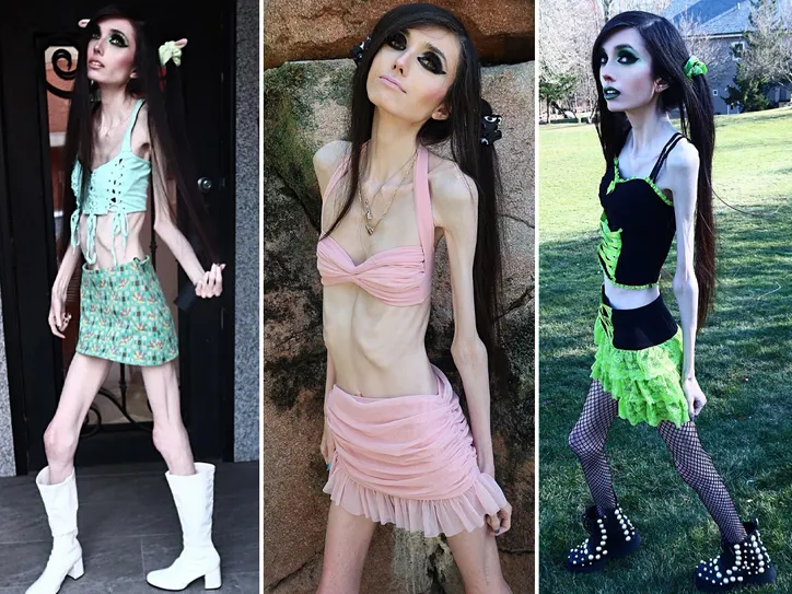 YouTuber Eugenia Cooney's thin look raises alarm with multiple 911 calls