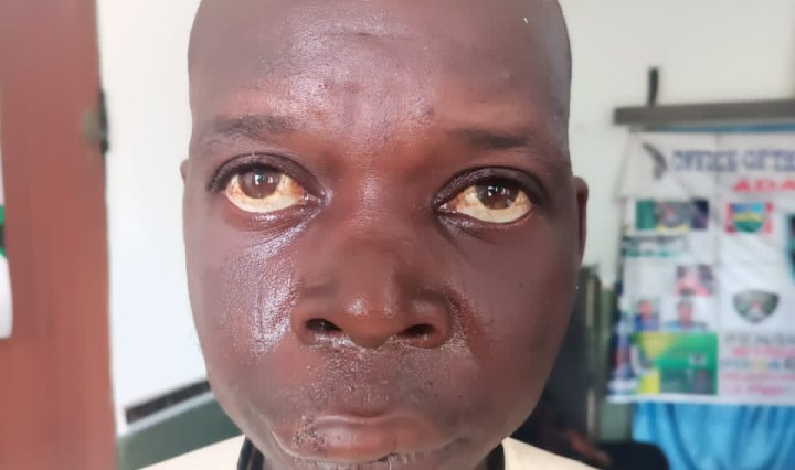 39-year-old man who raped an underage girl blames it on a local beer named Burukutu