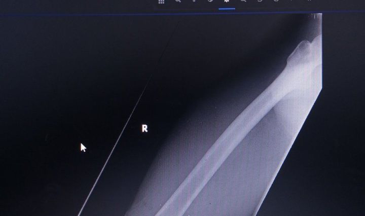 Nigerian soldier criticizes tinubu's gifts to super eagles after injury