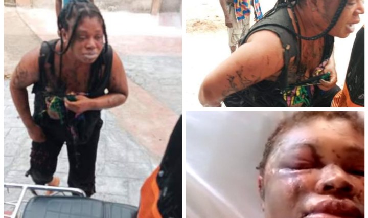 Man allegedly pours acid on his wife in Rivers state